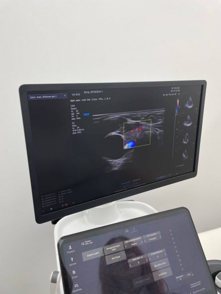 Чекап «УЗИ всего организма для женщин» в Ростове