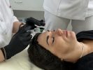 Коррекция носа филлерами без операции
