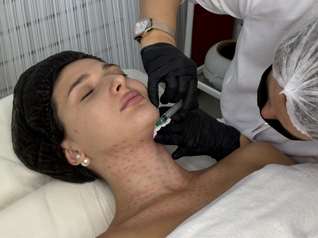 Контурная пластика подбородка: путь к совершенному профилю