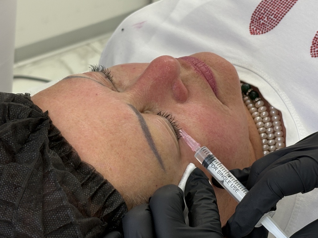 Мешки под глазами: поможет ли косметология?