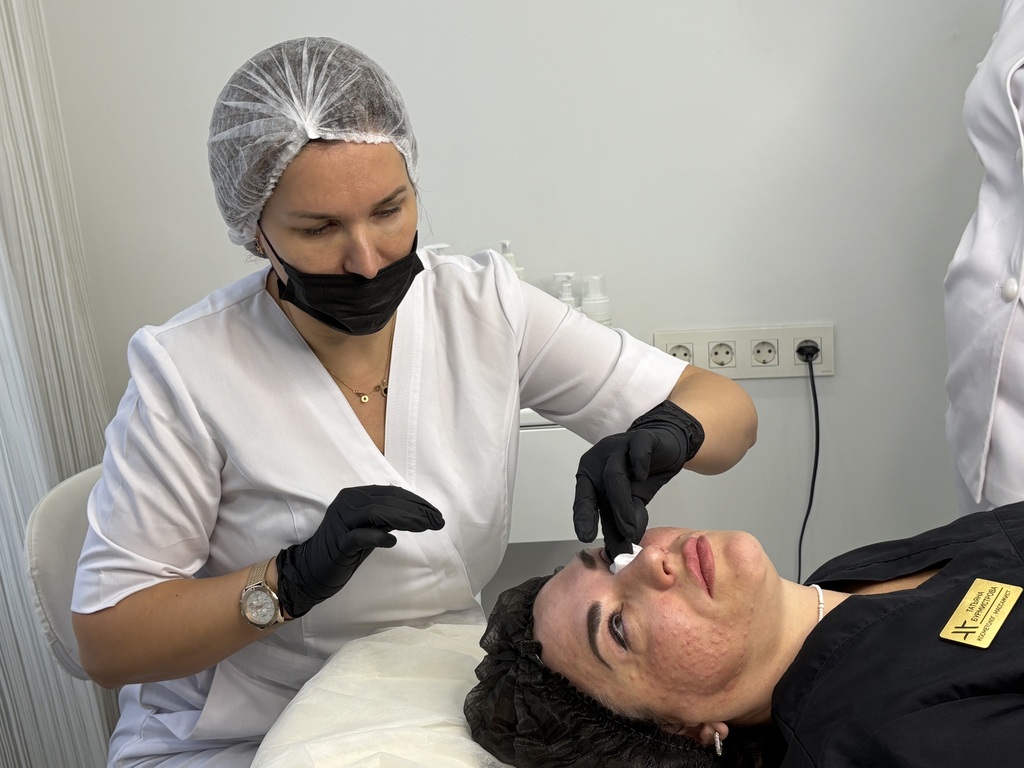 Омоложение глаз