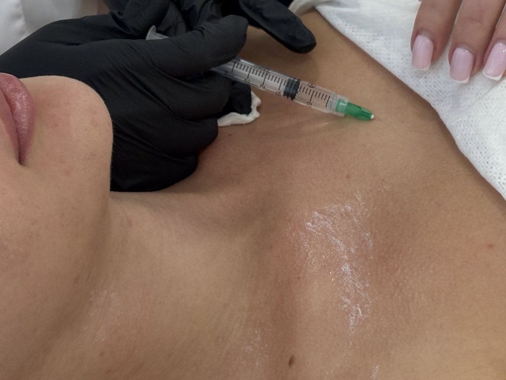 Омоложение шеи